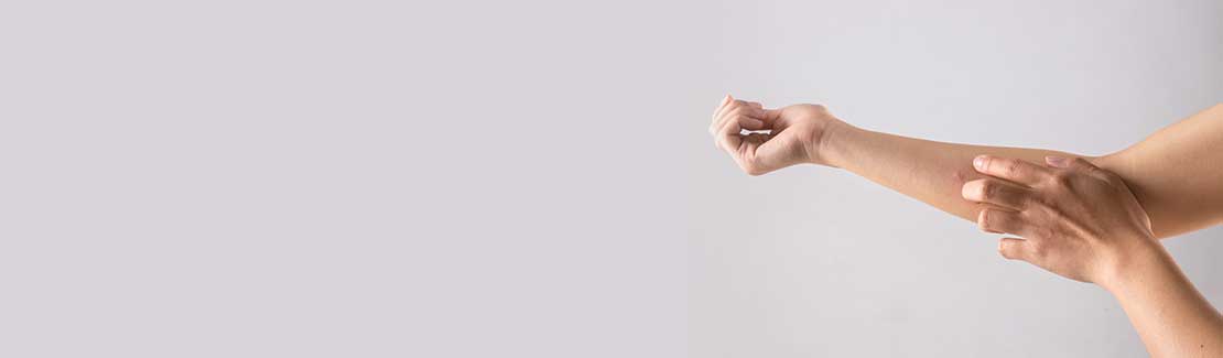 Verbrennungen & Insektenstiche